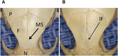 Interfrontal Bone Among Inbred Strains of Mice and QTL Mapping